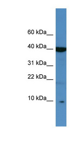 SPINK6 Antibody - SPINK6 antibody Western blot of Jurkat lysate. This image was taken for the unconjugated form of this product. Other forms have not been tested.