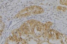 SPINK7 / ECRG2 Antibody - 1:100 staining human uterus tissue by IHC-P. The sample was formaldehyde fixed and a heat mediated antigen retrieval step in citrate buffer was performed. The sample was then blocked and incubated with the antibody for 1.5 hours at 22°C. An HRP conjugated goat anti-rabbit antibody was used as the secondary.