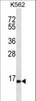 SPINK8 Antibody - SPINK8 Antibody western blot of K562 cell line lysates (35 ug/lane). The SPINK8 antibody detected the SPINK8 protein (arrow).