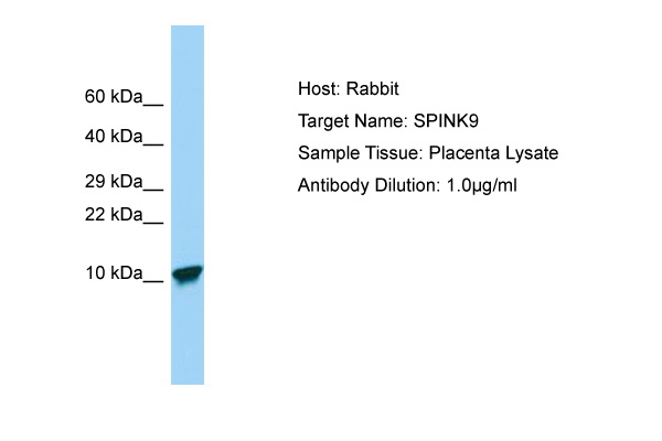 SPINK9 Antibody -  This image was taken for the unconjugated form of this product. Other forms have not been tested.