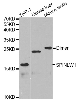 SPINLW1 / EPPIN Antibody - Western blot analysis of extracts of various cells.