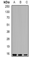 SPINLW1 / EPPIN Antibody - Western blot analysis of Eppin expression in THP1 (A); mouse liver (B); mouse testis (C) whole cell lysates.