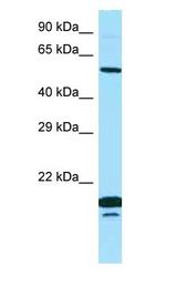 SPINT1 / HAI-1 Antibody - SPINT1 / HAI-1 antibody Western Blot of PANC1.  This image was taken for the unconjugated form of this product. Other forms have not been tested.