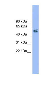 SPINT1 / HAI-1 Antibody - SPINT1 antibody Western blot of Fetal Muscle lysate. This image was taken for the unconjugated form of this product. Other forms have not been tested.