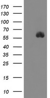 SPINT1 / HAI-1 Antibody - HEK293T cells were transfected with the pCMV6-ENTRY control (Left lane) or pCMV6-ENTRY SPINT1 (Right lane) cDNA for 48 hrs and lysed. Equivalent amounts of cell lysates (5 ug per lane) were separated by SDS-PAGE and immunoblotted with anti-SPINT1.