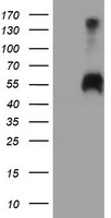 SPINT1 / HAI-1 Antibody - HEK293T cells were transfected with the pCMV6-ENTRY control (Left lane) or pCMV6-ENTRY SPINT1 (Right lane) cDNA for 48 hrs and lysed. Equivalent amounts of cell lysates (5 ug per lane) were separated by SDS-PAGE and immunoblotted with anti-SPINT1.