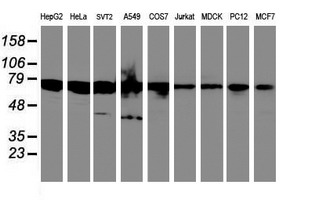 SPINT1 / HAI-1 Antibody - Western blot of extracts (35 ug) from 9 different cell lines by using anti-SPINT1 monoclonal antibody.