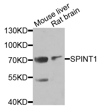 SPINT1 / HAI-1 Antibody - Western blot analysis of extracts of various cells.