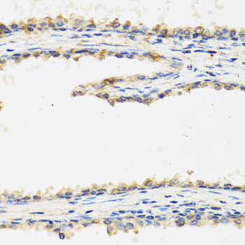 SPINT1 / HAI-1 Antibody - Immunohistochemistry of paraffin-embedded human prostate.