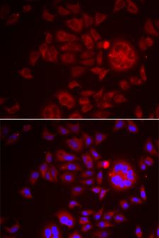 SPINT1 / HAI-1 Antibody - Immunofluorescence analysis of HeLa cells.