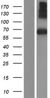SPINT1 / HAI-1 Protein - Western validation with an anti-DDK antibody * L: Control HEK293 lysate R: Over-expression lysate