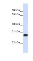 SPINT2 / HAI-2 Antibody - SPINT2 antibody Western blot of Fetal Heart lysate. This image was taken for the unconjugated form of this product. Other forms have not been tested.