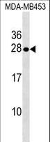 SPINT2 / HAI-2 Antibody - SPINT2 Antibody western blot of MDA-MB453 cell line lysates (35 ug/lane). The SPINT2 antibody detected the SPINT2 protein (arrow).