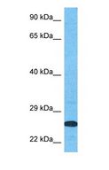 SPINT2 / HAI-2 Antibody - Western blot of SPIT2 Antibody with human MCF7 Whole Cell lysate.  This image was taken for the unconjugated form of this product. Other forms have not been tested.