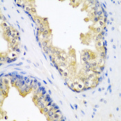 SPINT2 / HAI-2 Antibody - Immunohistochemistry of paraffin-embedded human prostate.