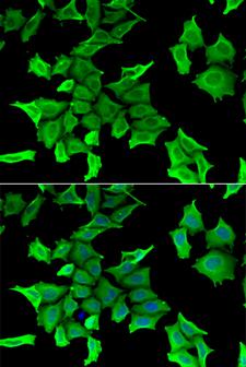 SPINT2 / HAI-2 Antibody - Immunofluorescence analysis of HeLa cells.