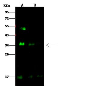 SPINT2 / HAI-2 Antibody - Anti-SPINT2 rabbit polyclonal antibody at 1:500 dilution. Lane A: MCF7 Whole Cell Lysate. Lane B: Caco2 Whole Cell Lysate. Lysates/proteins at 30 ug per lane. Secondary: Goat Anti-Rabbit IgG H&L (Dylight 800) at 1/10000 dilution. Developed using the Odyssey technique. Performed under reducing conditions. Predicted band size: 28 kDa. Observed band size: 34 kDa. (We are unsure as to the identity of these extra bands.)