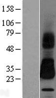 SPINT2 / HAI-2 Protein - Western validation with an anti-DDK antibody * L: Control HEK293 lysate R: Over-expression lysate