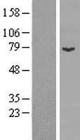 SPIRE1 Protein - Western validation with an anti-DDK antibody * L: Control HEK293 lysate R: Over-expression lysate