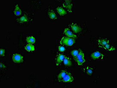SPIRE2 Antibody - Immunofluorescent analysis of MCF-7 cells using SPIRE2 Antibody at dilution of 1:100 and Alexa Fluor 488-congugated AffiniPure Goat Anti-Rabbit IgG(H+L)