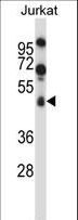 SPN / CD43 Antibody - SPN/CD43 Antibody western blot of Jurkat cell line lysates (35 ug/lane). The SPN/CD43 antibody detected the SPN/CD43 protein (arrow).