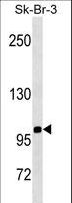 SPN / CD43 Antibody - SPN/CD43 Antibody western blot of SK-BR-3 cell line lysates (35 ug/lane). The SPN/CD43 antibody detected the SPN/CD43 protein (arrow).