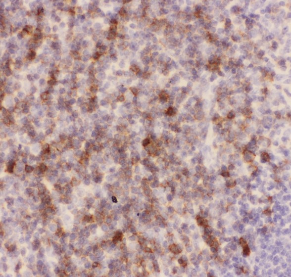SPN / CD43 Antibody - CD43 antibody IHC-paraffin: Mouse Spleen Tissue.
