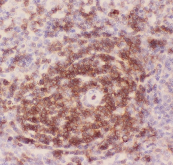 SPN / CD43 Antibody - CD43 antibody IHC-paraffin: Rat Spleen Tissue.