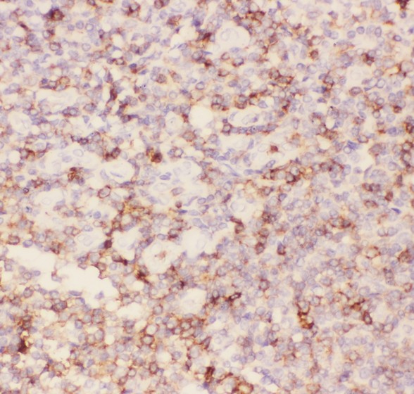 SPN / CD43 Antibody - CD43 antibody IHC-paraffin: Human Tonsil Tissue.