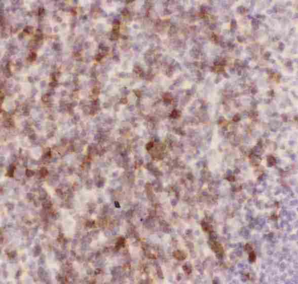SPN / CD43 Antibody - IHC analysis of CD43 using anti-CD43 antibody. CD43 was detected in paraffin-embedded section of mouse spleen tissues. Heat mediated antigen retrieval was performed in citrate buffer (pH6, epitope retrieval solution) for 20 mins. The tissue section was blocked with 10% goat serum. The tissue section was then incubated with 1µg/ml rabbit anti-CD43 Antibody overnight at 4°C. Biotinylated goat anti-rabbit IgG was used as secondary antibody and incubated for 30 minutes at 37°C. The tissue section was developed using Strepavidin-Biotin-Complex (SABC) with DAB as the chromogen.