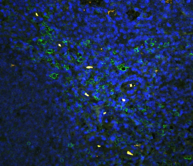 SPN / CD43 Antibody - IF analysis of CD43 using anti-CD43 antibody CD43 was detected in paraffin-embedded section of human tonsil tissues. Heat mediated antigen retrieval was performed in citrate buffer (pH6, epitope retrieval solution ) for 20 mins. The tissue section was blocked with 10% goat serum. The tissue section was then incubated with 1µg/mL rabbit anti-CD43 Antibody overnight at 4°C. DyLight®488 Conjugated Goat Anti-Rabbit IgG was used as secondary antibody at 1:100 dilution and incubated for 30 minutes at 37°C. The section was counterstained with DAPI. Visualize using a fluorescence microscope and filter sets appropriate for the label used.