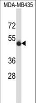 SPN / CD43 Antibody - SPN/CD43 Antibody western blot of MDA-MB435 cell line lysates (35 ug/lane). The SPN/CD43 antibody detected the SPN/CD43 protein (arrow).
