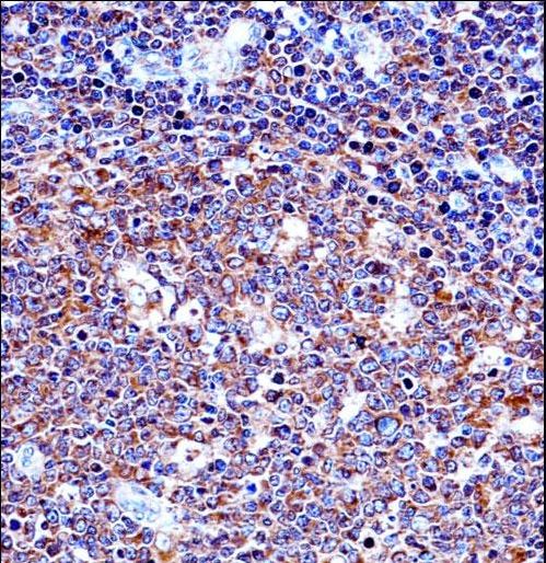 SPN / CD43 Antibody - SPN/CD43 Antibody immunohistochemistry of formalin-fixed and paraffin-embedded human tonsil tissue followed by peroxidase-conjugated secondary antibody and DAB staining.