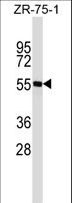 SPN / CD43 Antibody - SPN Antibody western blot of ZR-75-1 cell line lysates (35 ug/lane). The SPN antibody detected the SPN protein (arrow).