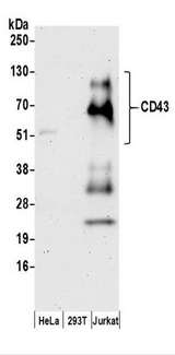 SPN / CD43 Antibody - Detection of Human CD43 by Western Blot. Samples: Whole cell lysate (50 ug) prepared using RIPA buffer from HeLa, 293T, and Jurkat cells. Antibodies: Affinity purified rabbit anti-CD43 antibody used for WB at 0.1 ug/ml. Detection: Chemiluminescence with an exposure time of 3 minutes.