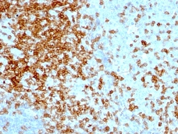 SPN / CD43 Antibody - Formalin-fixed, paraffin-embedded human tonsil stained with CD43 antibody (84-3C1).  This image was taken for the unmodified form of this product. Other forms have not been tested.
