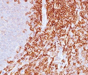 SPN / CD43 Antibody - CD43 antibody DF-T1 immunohistochemistry spleen.  This image was taken for the unmodified form of this product. Other forms have not been tested.