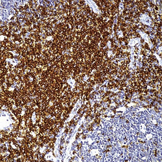 SPN / CD43 Antibody - Formalin-fixed, paraffin-embedded human tonsil stained with CD43, T cell antibody.