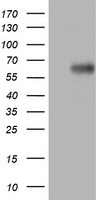 SPN / CD43 Antibody - HEK293T cells were transfected with the pCMV6-ENTRY control (Left lane) or pCMV6-ENTRY SPN (Right lane) cDNA for 48 hrs and lysed. Equivalent amounts of cell lysates (5 ug per lane) were separated by SDS-PAGE and immunoblotted with anti-SPN.