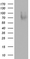 SPN / CD43 Antibody - HEK293T cells were transfected with the pCMV6-ENTRY control (Left lane) or pCMV6-ENTRY SPN (Right lane) cDNA for 48 hrs and lysed. Equivalent amounts of cell lysates (5 ug per lane) were separated by SDS-PAGE and immunoblotted with anti-SPN.