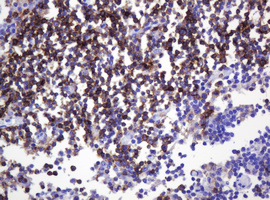 SPN / CD43 Antibody - IHC of paraffin-embedded Human lymph node tissue using anti-SPN mouse monoclonal antibody.