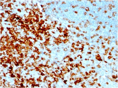 SPN / CD43 Antibody - Formalin-fixed, paraffin-embedded human Tonsil stained with CD43 Mouse Recombinant Monoclonal Antibody (rSPN/1094).