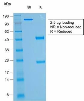 SPN / CD43 Antibody - SDS-PAGE Analysis Purified CD43 Mouse Recombinant Monoclonal Antibody (rSPN/1094). Confirmation of Purity and Integrity of Antibody.