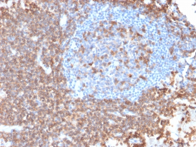 SPN / CD43 Antibody - Formalin-fixed, paraffin-embedded human Lymph Node stained with CD43 Mouse Recombinant Monoclonal Antibody (rSPN/839).