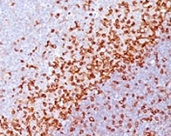 SPN / CD43 Antibody - Formalin-fixed, paraffin-embedded human spleen stained with CD43 antibody (SPM503).  This image was taken for the unmodified form of this product. Other forms have not been tested.