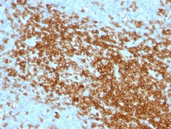 SPN / CD43 Antibody - Formalin-fixed, paraffin-embedded human tonsil stained with CD43 antibody (SPN/1094).  This image was taken for the unmodified form of this product. Other forms have not been tested.
