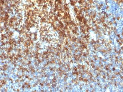 SPN / CD43 Antibody - Formalin-fixed, paraffin-embedded human Tonsil stained with CD43 Rabbit Recombinant Monoclonal Antibody (SPN/1766R).