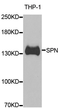 SPN / CD43 Antibody - Western blot analysis of extracts of THP-1 cells.