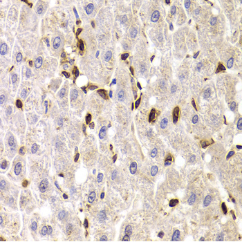SPN / CD43 Antibody - Immunohistochemistry of paraffin-embedded human liver injury tissue.