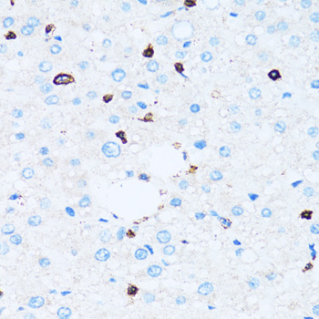 SPN / CD43 Antibody - Immunohistochemistry of paraffin-embedded human liver tissue.